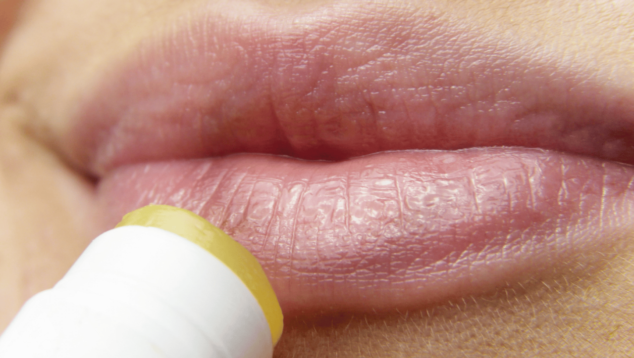 Image of Dark Lips Treatment in Cheras at Ru Xi Xing Beauty & Hair Salon