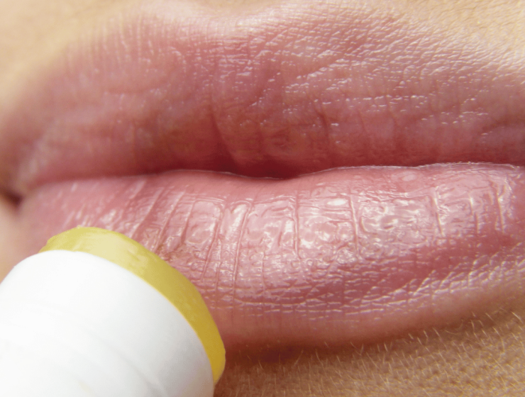 Image of Dark Lips Treatment in Cheras at Ru Xi Xing Beauty & Hair Salon